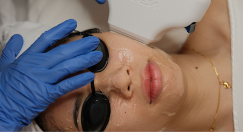 Cleanse & Application of Cooling Gel