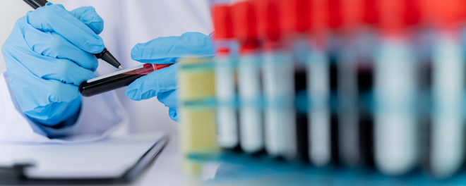 Blood and Hormone Tests