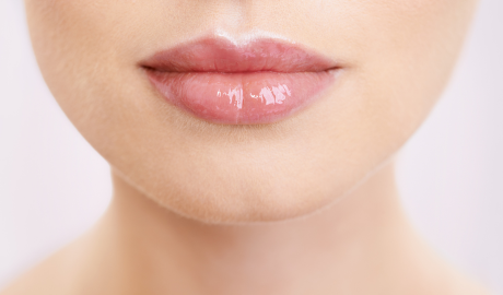 Perioral Line Reduction