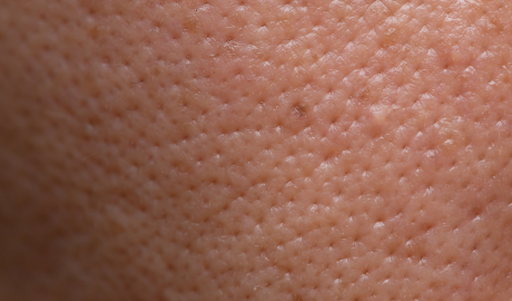 Tone and Texture Refinement