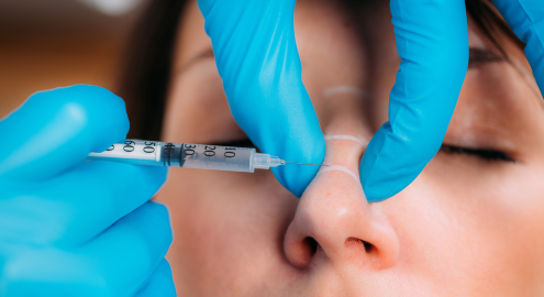 Dermal Filler Injection